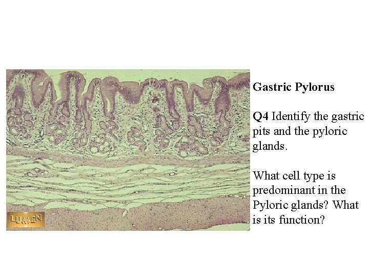 Gastric Pylorus Q 4 Identify the gastric pits and the pyloric glands. What cell