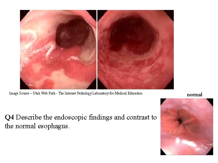 Image Source – Utah Web Path - The Internet Pathology Laboratory for Medical Education