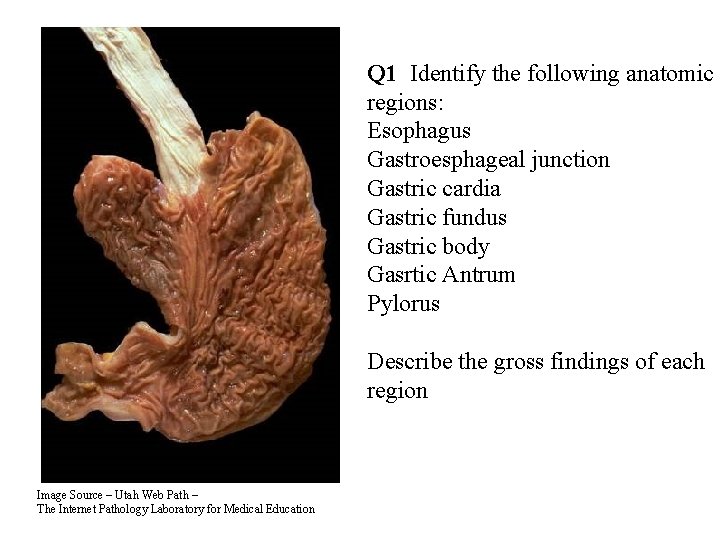 Q 1 Identify the following anatomic regions: Esophagus Gastroesphageal junction Gastric cardia Gastric fundus