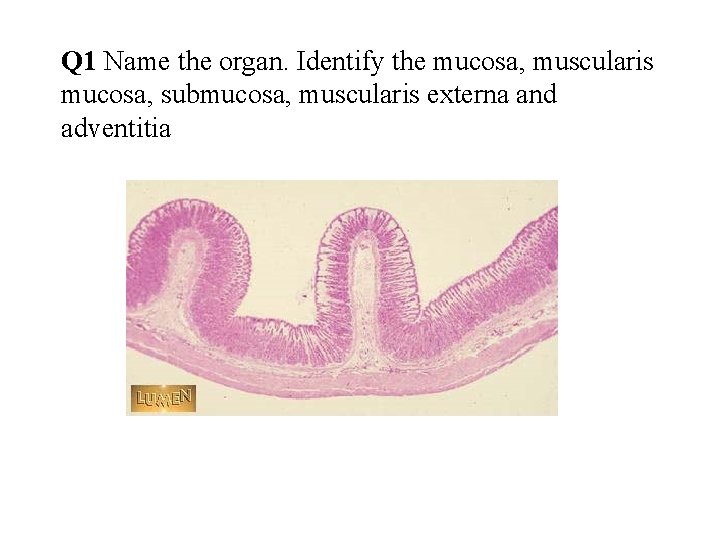 Q 1 Name the organ. Identify the mucosa, muscularis mucosa, submucosa, muscularis externa and