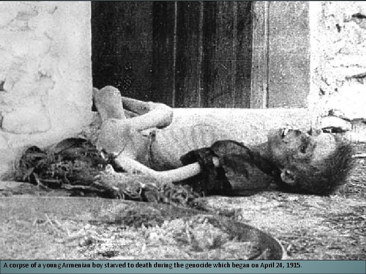 A corpse of a young Armenian boy starved to death during the genocide which