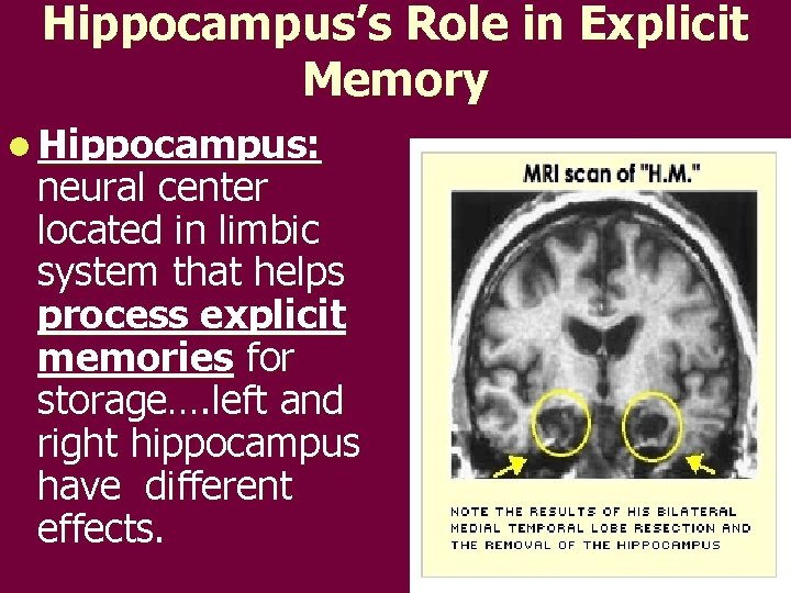 Hippocampus’s Role in Explicit Memory l Hippocampus: neural center located in limbic system that