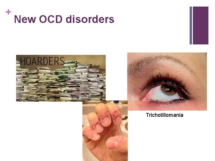 + New OCD disorders Trichotillomania 