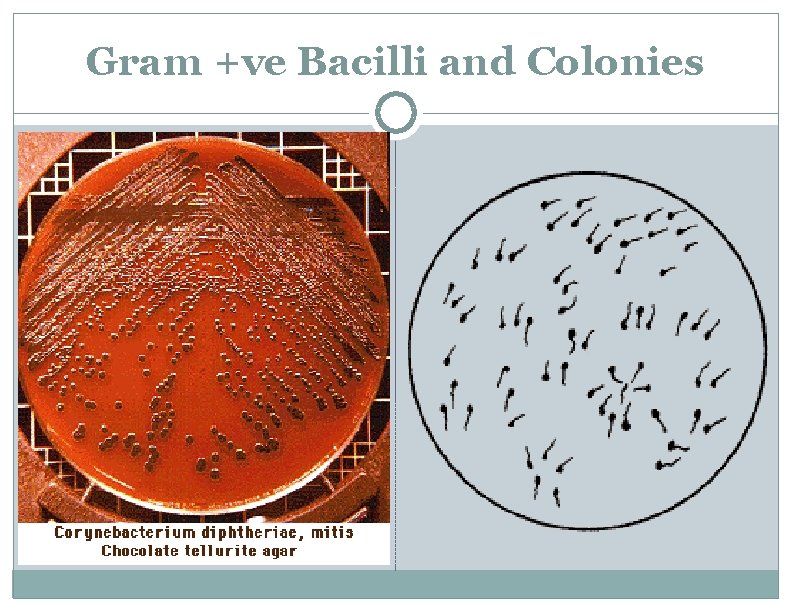 Gram +ve Bacilli and Colonies 