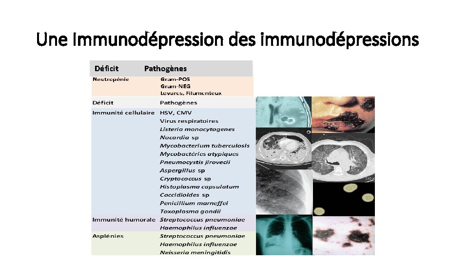 Une Immunodépression des immunodépressions Déficit Pathogènes 