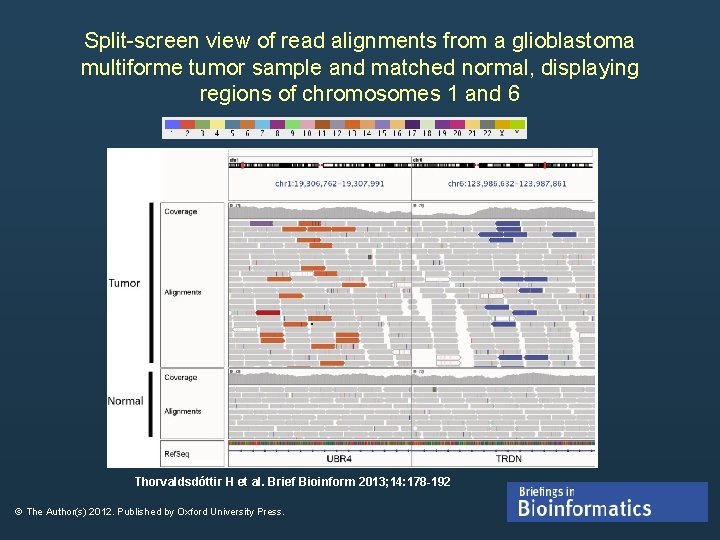 Split-screen view of read alignments from a glioblastoma multiforme tumor sample and matched normal, Split-screen view of read alignments from a glioblastoma multiforme tumor sample and matched normal,