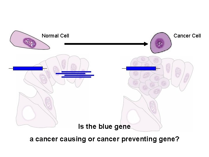 Normal Cell Cancer Cell Is the blue gene a cancer causing or cancer preventing