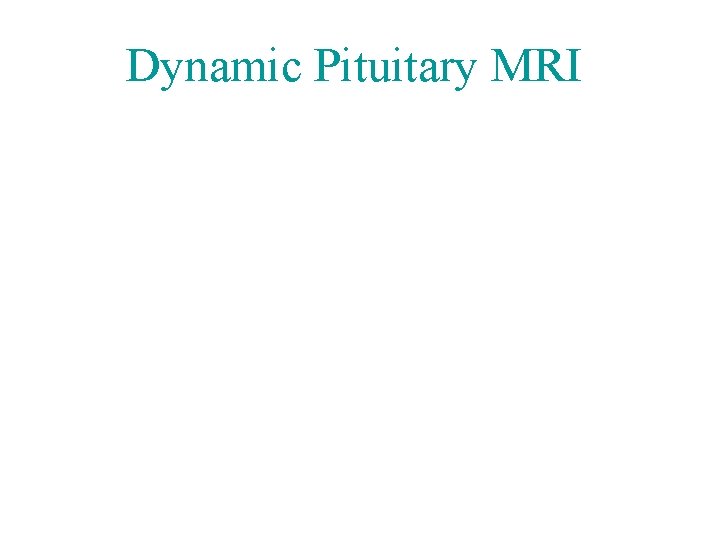 Dynamic Pituitary MRI 