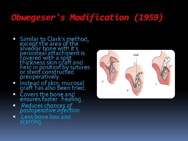Obwegeser's Modification (1959) Similar to Clark's method, except the area of the alveolar bone