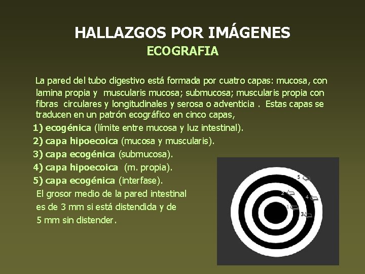HALLAZGOS POR IMÁGENES ECOGRAFIA La pared del tubo digestivo está formada por cuatro capas: