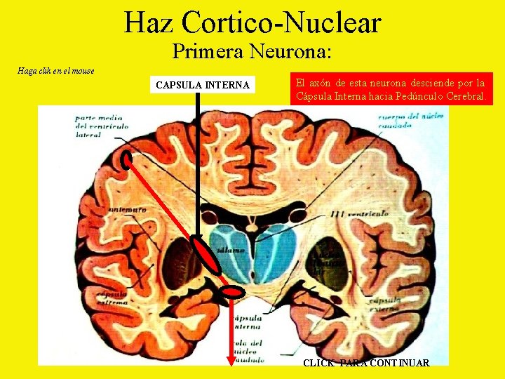 Haz Cortico-Nuclear Primera Neurona: Haga clik en el mouse CAPSULA INTERNA El axón de