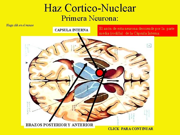 Haz Cortico-Nuclear Primera Neurona: Haga clik en el mouse CAPSULA INTERNA BRAZOS POSTERIOR Y