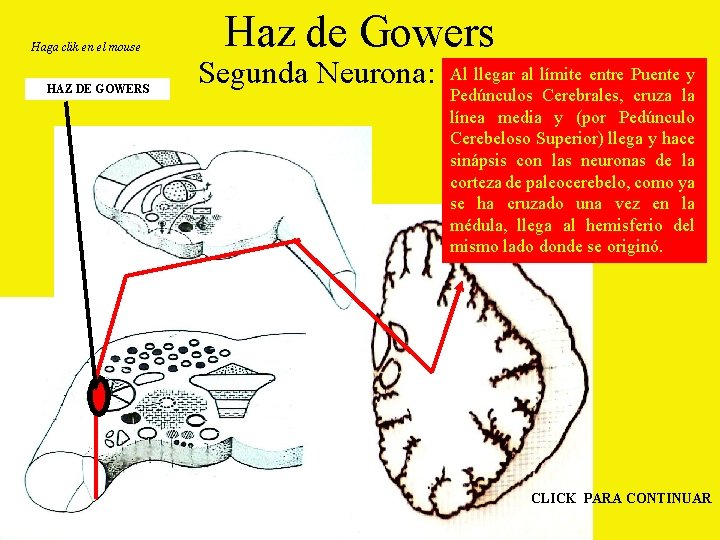 Haga clik en el mouse HAZ DE GOWERS Haz de Gowers Segunda Neurona: Al