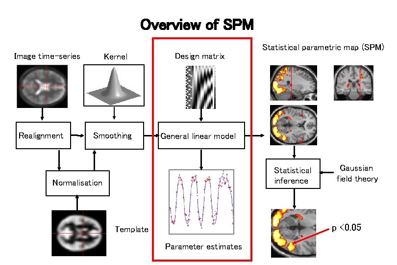 Overview of SPM Image time-series Realignment Kernel Smoothing Design matrix Statistical parametric map (SPM)