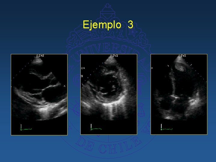 Ejemplo 3 