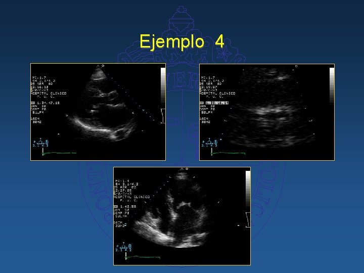 Ejemplo 4 