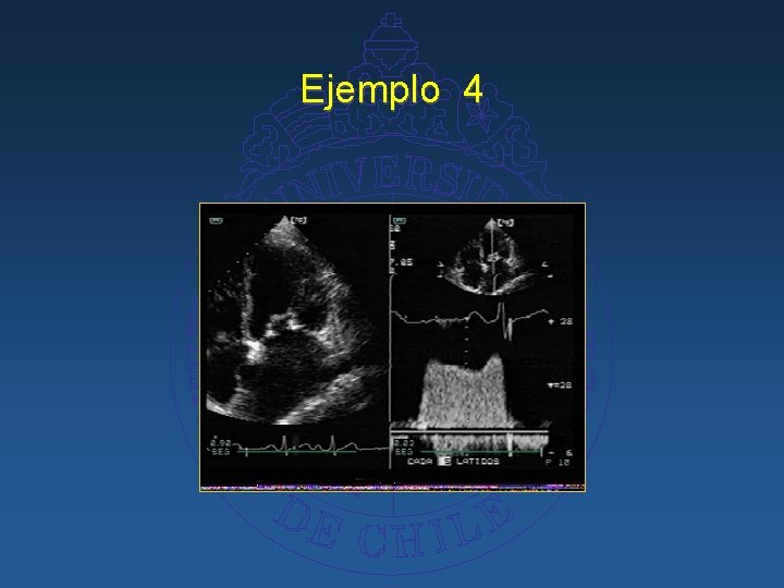 Ejemplo 4 
