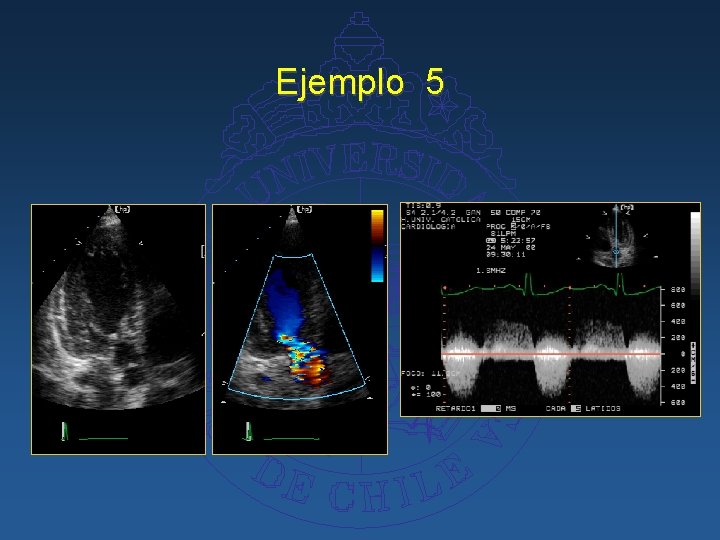 Ejemplo 5 