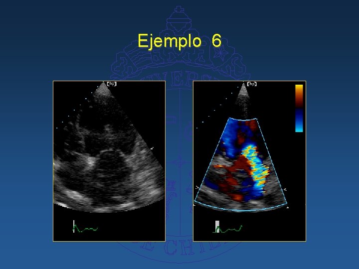 Ejemplo 6 