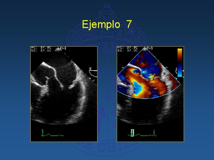 Ejemplo 7 