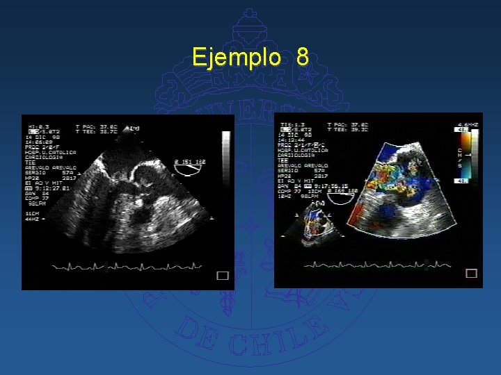 Ejemplo 8 