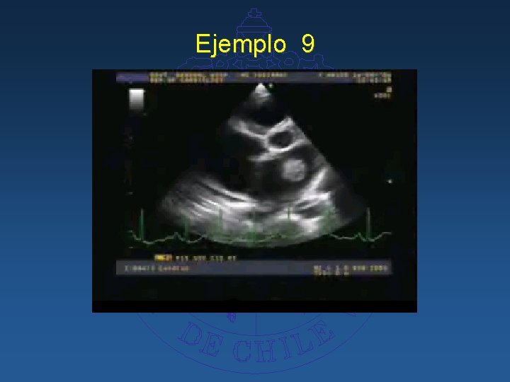 Ejemplo 9 