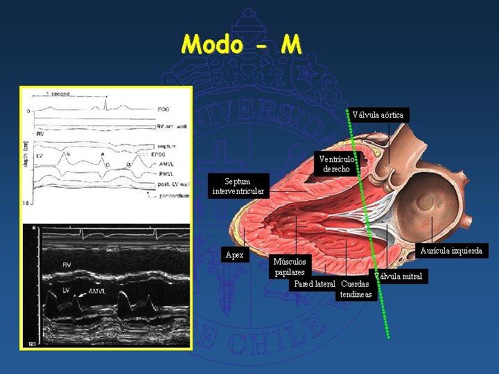 Modo - M Válvula aórtica Ventrículo derecho Septum interventricular Apex Aurícula izquierda Músculos papilares