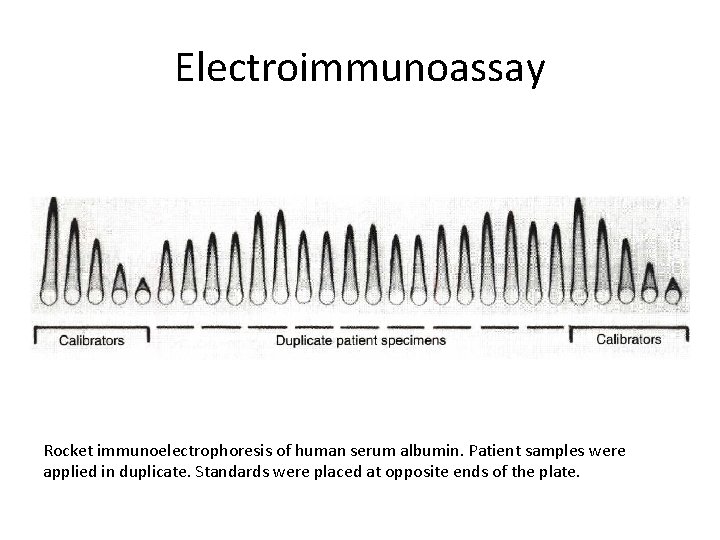 Electroimmunoassay Rocket immunoelectrophoresis of human serum albumin. Patient samples were applied in duplicate. Standards