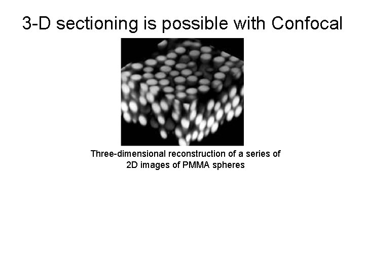 3 -D sectioning is possible with Confocal Three-dimensional reconstruction of a series of 2