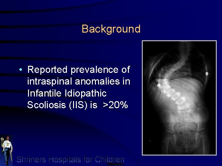 Background • Reported prevalence of intraspinal anomalies in Infantile Idiopathic Scoliosis (IIS) is >20%