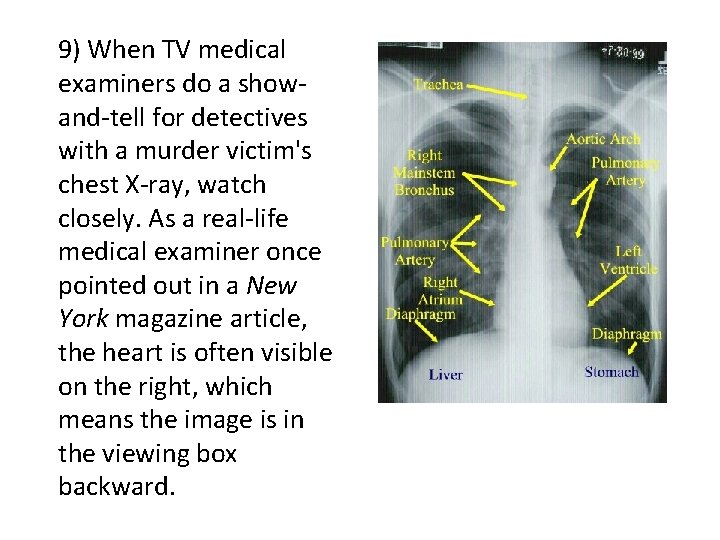 9) When TV medical examiners do a showand-tell for detectives with a murder victim's