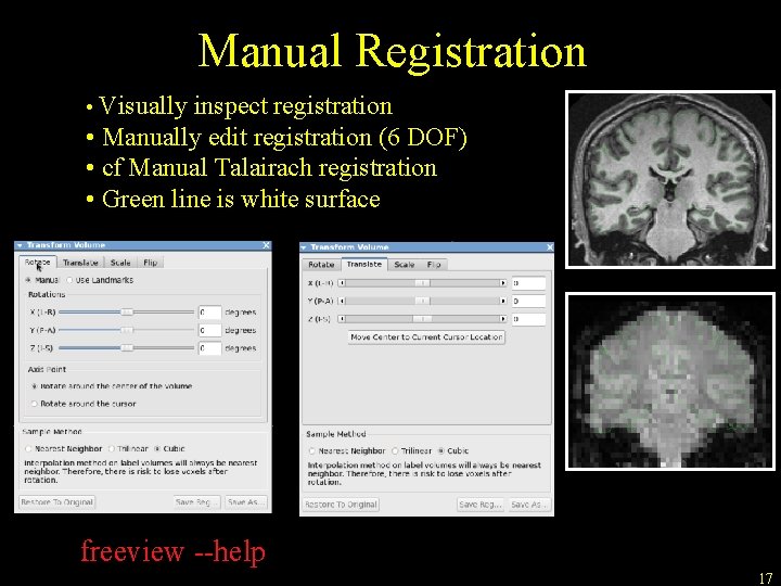 Manual Registration • Visually inspect registration • Manually edit registration (6 DOF) • cf