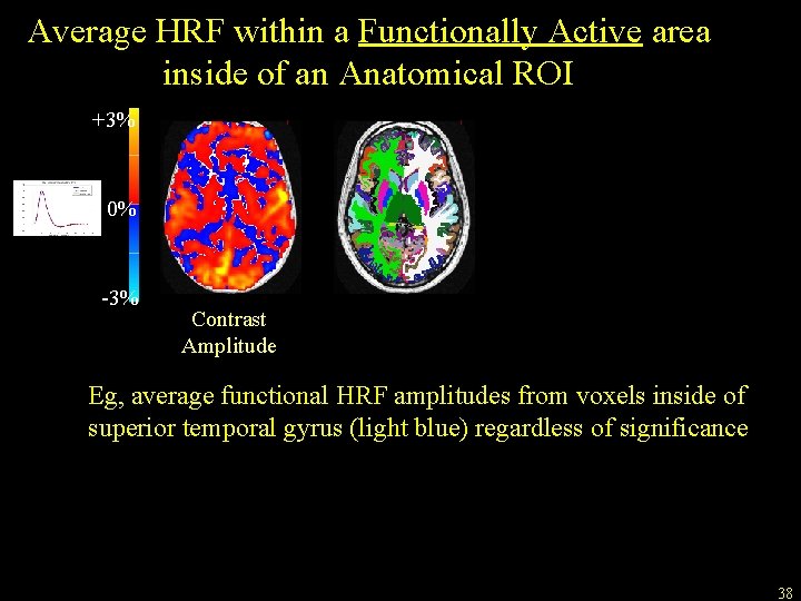 Average HRF within a Functionally Active area inside of an Anatomical ROI +3% 0%