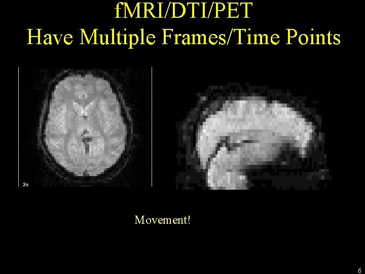 f. MRI/DTI/PET Have Multiple Frames/Time Points Movement! 6 
