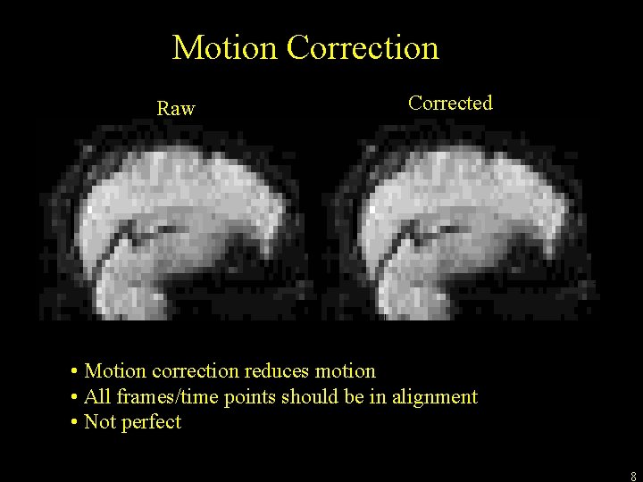 Motion Correction Raw Corrected • Motion correction reduces motion • All frames/time points should