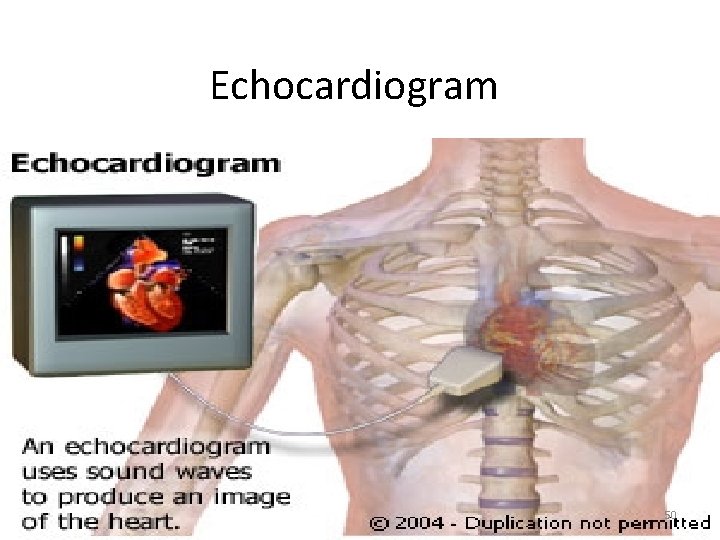 Echocardiogram 50 