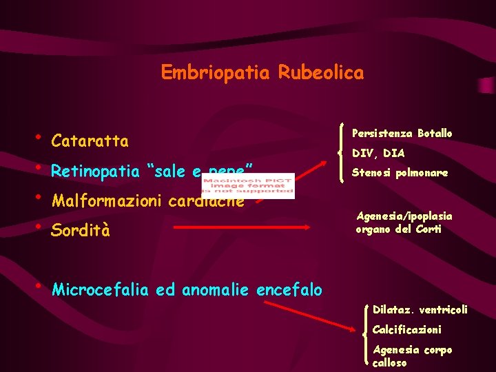 Embriopatia Rubeolica • Cataratta • Retinopatia “sale e pepe” • Malformazioni cardiache • Sordità