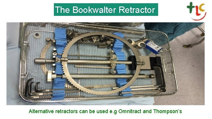 The Bookwalter Retractor Alternative retractors can be used e. g Omnitract and Thompson’s 