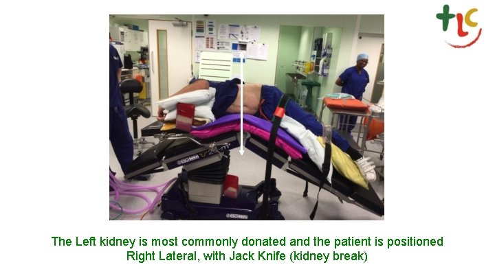 The Left kidney is most commonly donated and the patient is positioned Right Lateral,