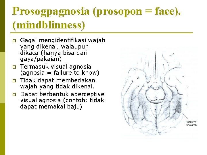 Prosogpagnosia (prosopon = face). (mindblinness) p p Gagal mengidentifikasi wajah yang dikenal, walaupun dikaca