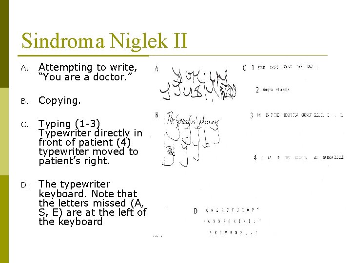 Sindroma Niglek II A. Attempting to write, “You are a doctor. ” B. Copying.