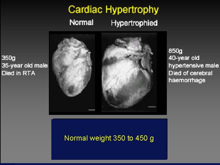 Normal weight 350 to 450 g www. drsarma. in 43 