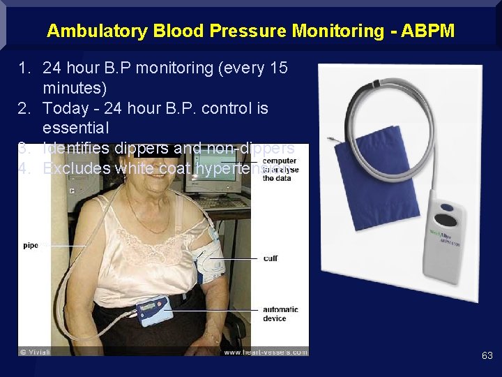 Ambulatory Blood Pressure Monitoring - ABPM 1. 24 hour B. P monitoring (every 15