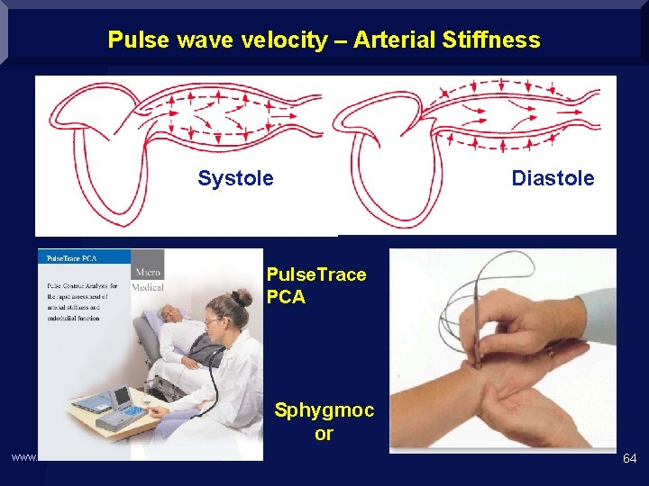 Pulse wave velocity – Arterial Stiffness Systole Diastole Pulse. Trace PCA Sphygmoc or www.