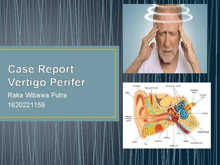 Case Report Vertigo Perifer Raka Wibawa Putra 1620221159 