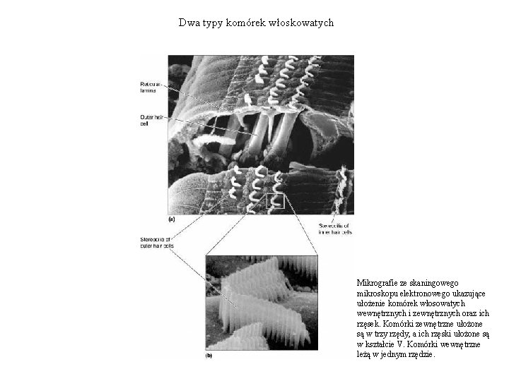 Dwa typy komórek włoskowatych Mikrografie ze skaningowego mikroskopu elektronowego ukazujące ułożenie komórek włosowatych wewnętrznych