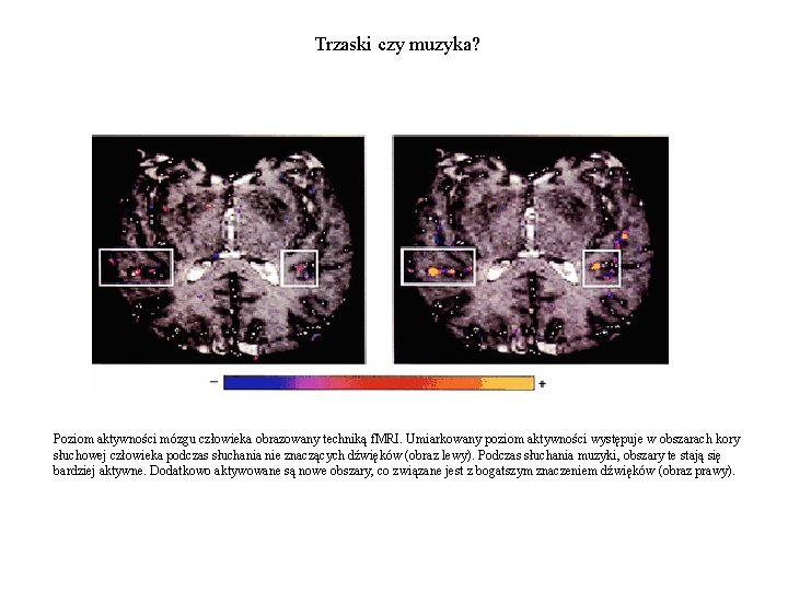 Trzaski czy muzyka? Poziom aktywności mózgu człowieka obrazowany techniką f. MRI. Umiarkowany poziom aktywności