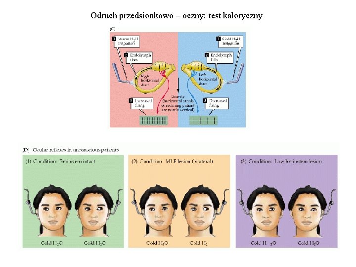 Odruch przedsionkowo – oczny: test kaloryczny 