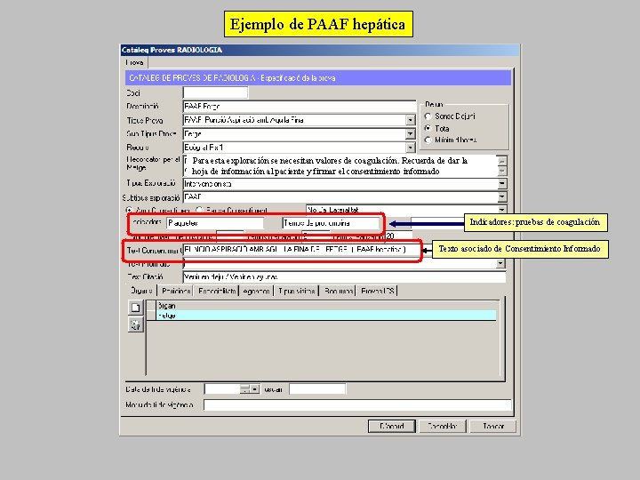 Ejemplo de PAAF hepática Para esta exploración se necesitan valores de coagulación. Recuerda de
