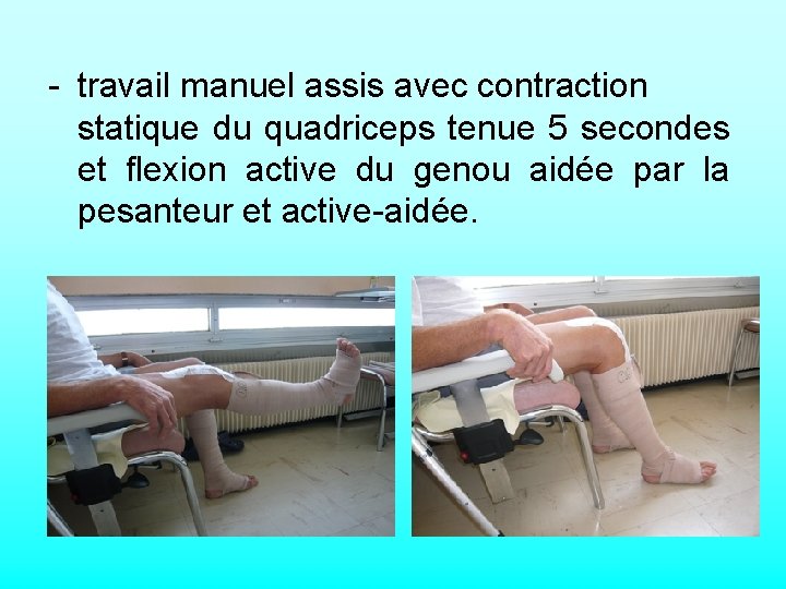 - travail manuel assis avec contraction statique du quadriceps tenue 5 secondes et flexion